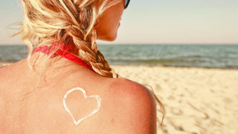 fitness-sunburn-help